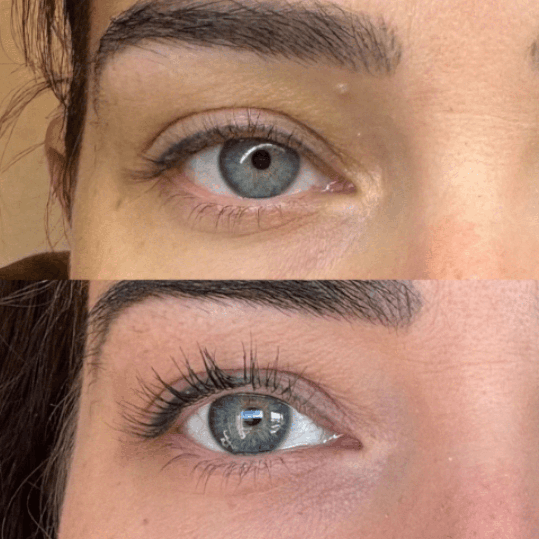 Lash serum