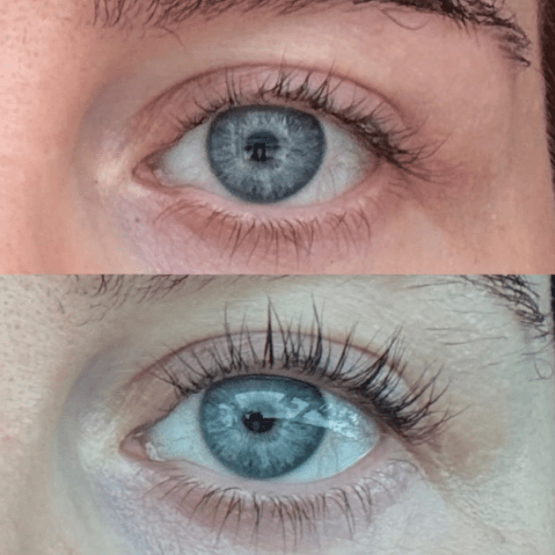 Lash serum