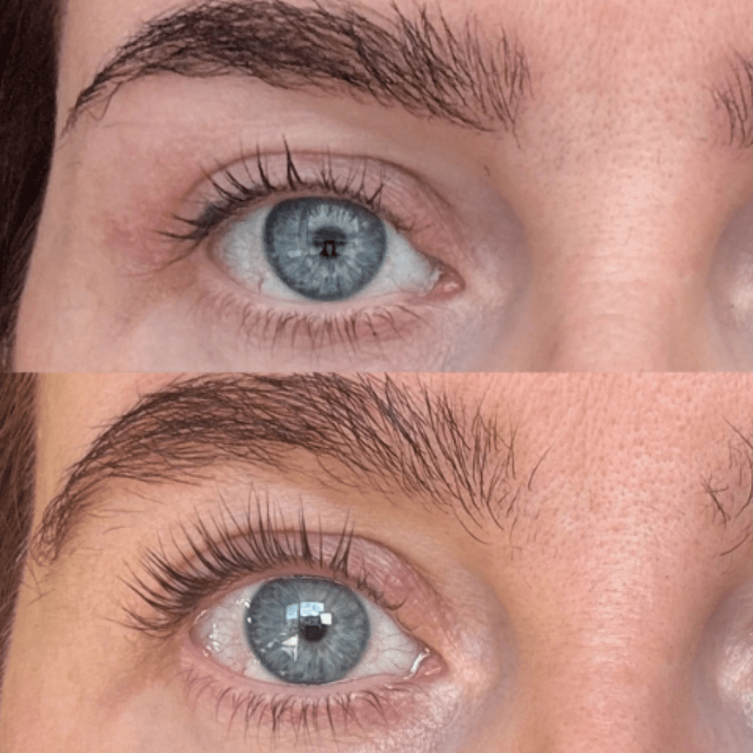 Lash serum
