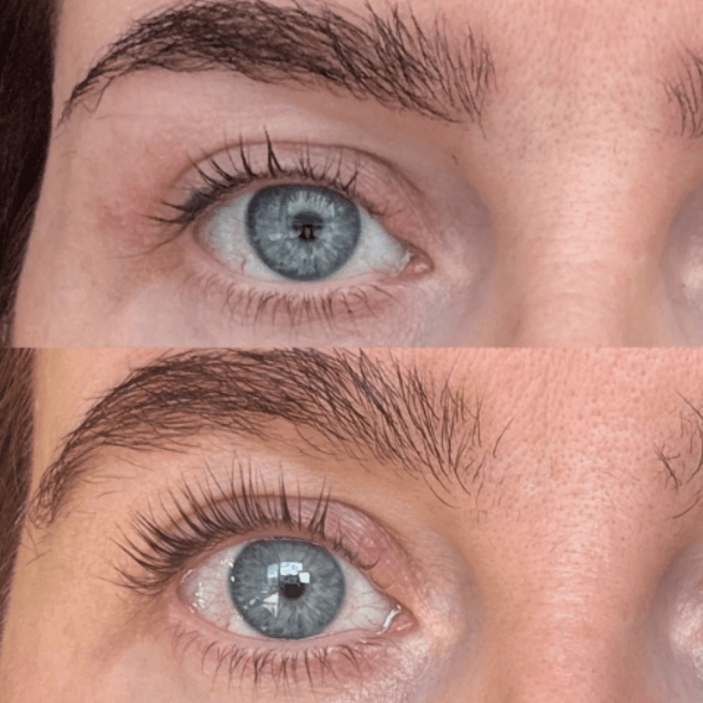 The complete lash set