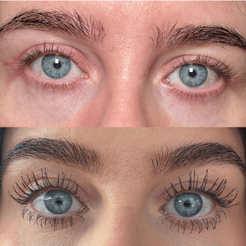 Lash Serum | INTENSE