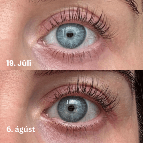 Lash Serum | INTENSE