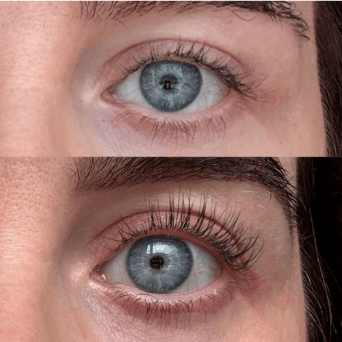Lash Serum | INTENSE